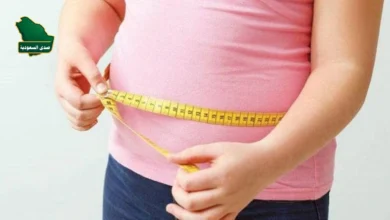 العلاقة بين السمنة وتراكم بروتينات الأميلويد في الدماغ المسبب للزهايمر